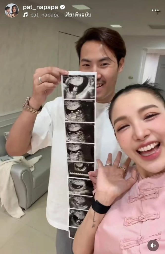 แพท ณปภา